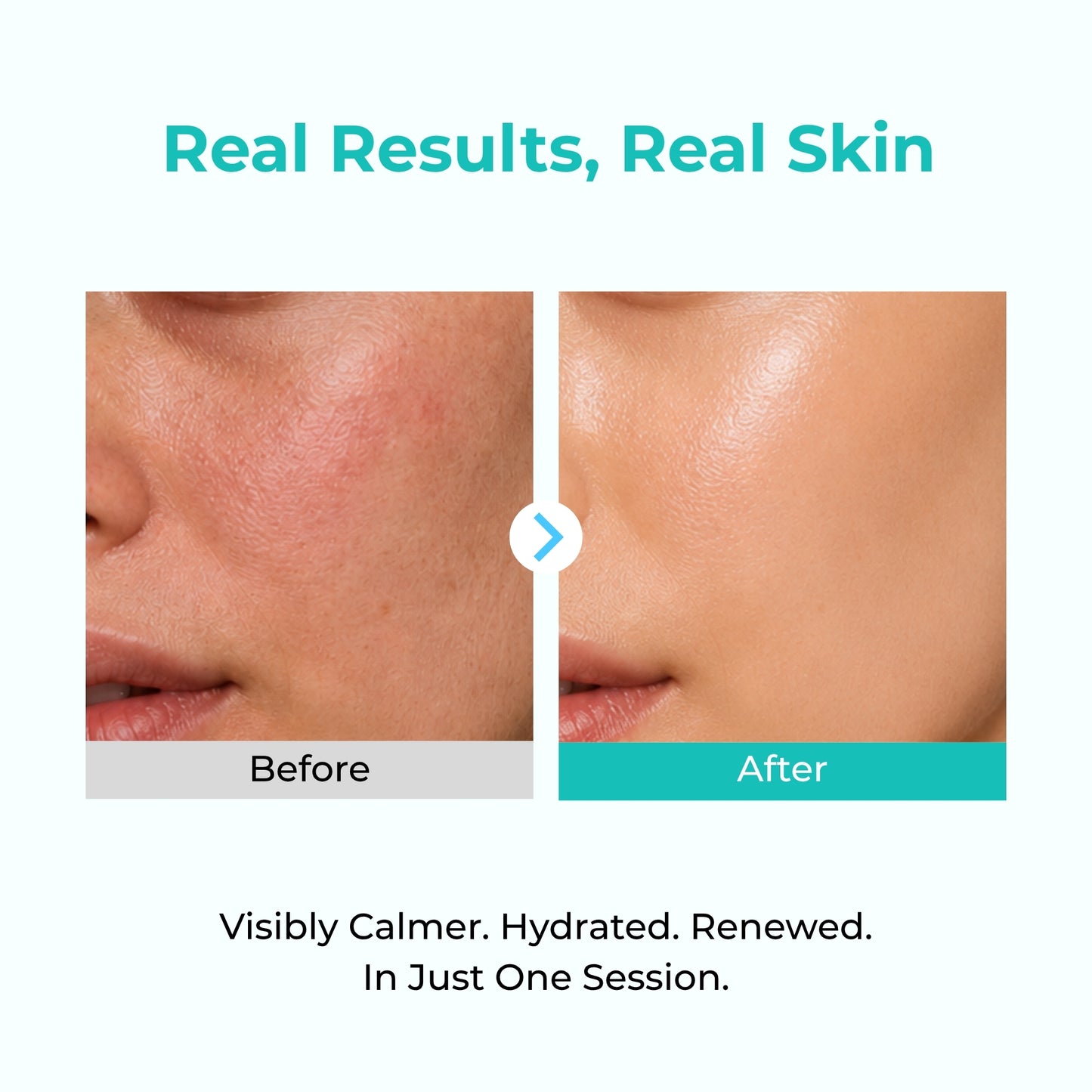 Lifting Collagen Ampoule Mask Pack
