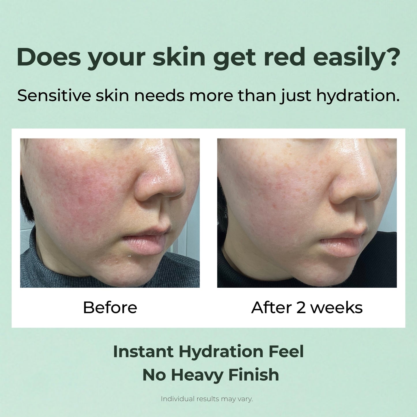 Cica PDRN Calm + Plump Serum